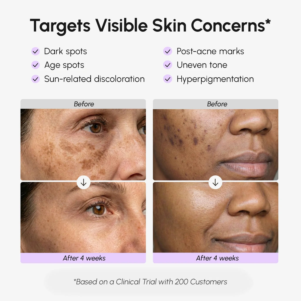 Marée Dark Spot Correcting Face & Body Serum
